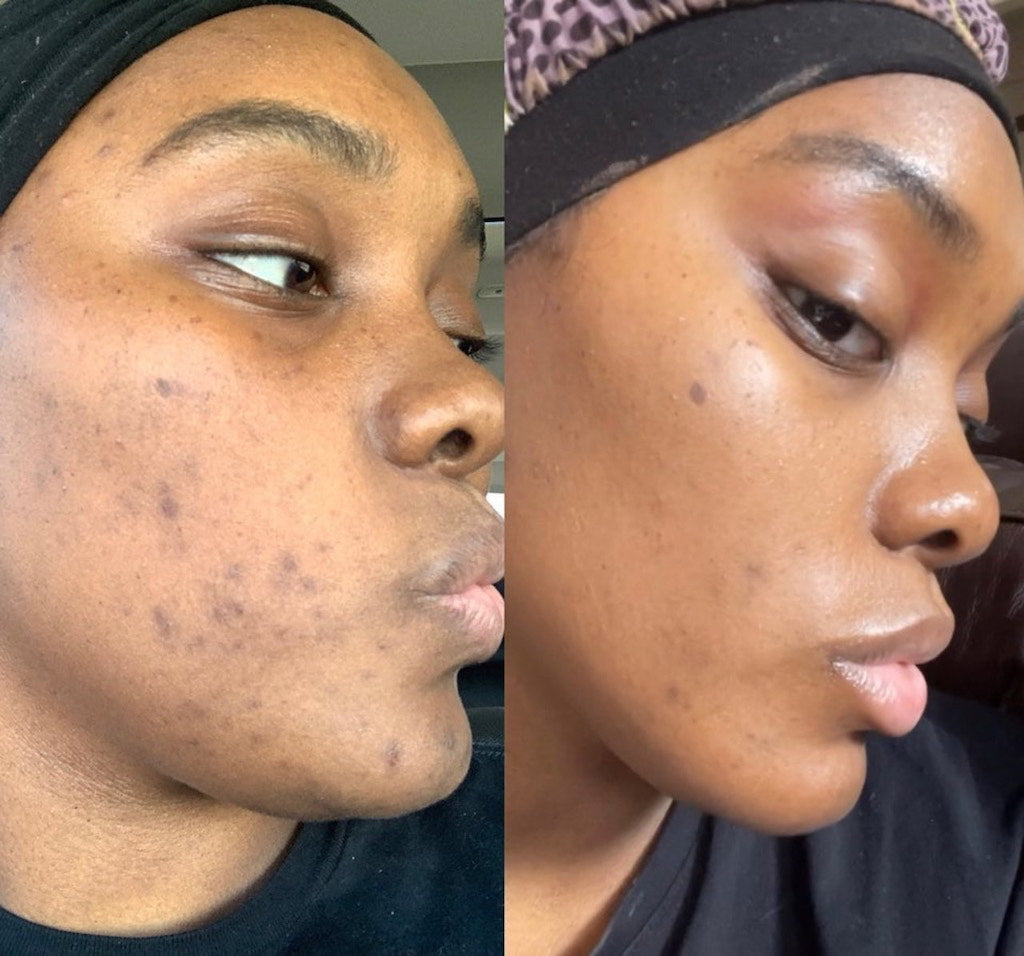 Radiance Serum Vitamin C, Peptides, CoQ10, Niacinamide, HA Aster Raine Radiance Serum Vitamin C, Peptides, CoQ10, Niacinamide, HA Aster Raine